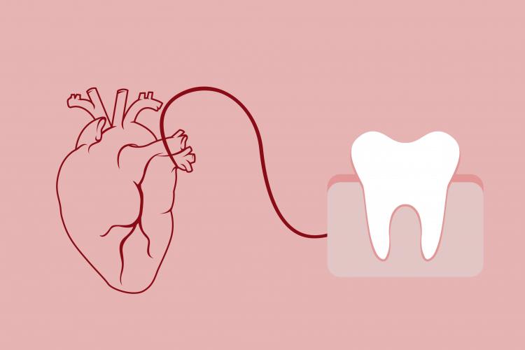 بیماران قلبی چگونه به سلامت دهان و دندان خود رسیدگی کنند؟ - دندانپزشکی برای بیماران قلبی
