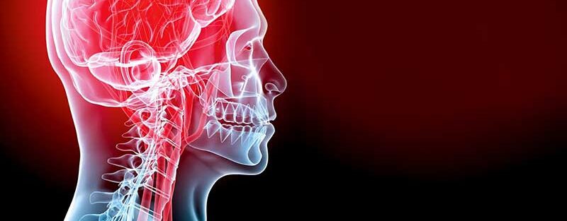 علائم حمله ایسکمی گذرا یا TIA