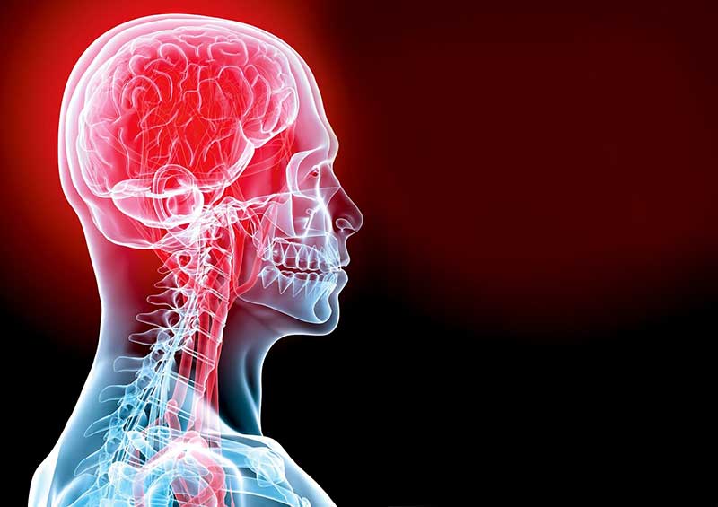 علائم حمله ایسکمی گذرا یا TIA