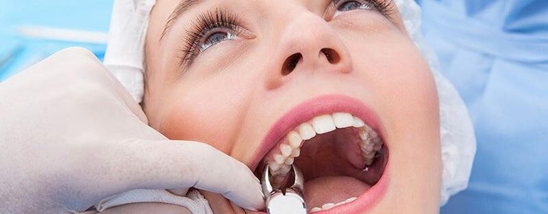 جلوگیری از خونریزی دندان پس از کشیدن