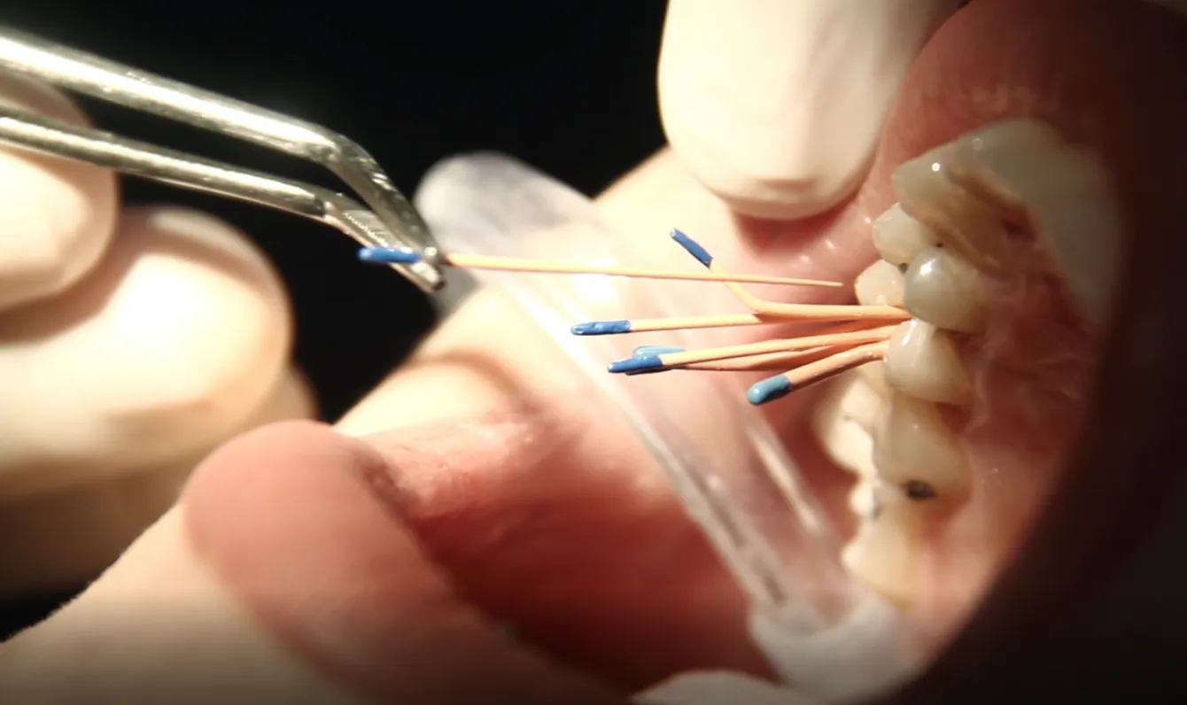 اگر دندان را عصب کشی نکنیم چه میشود؟