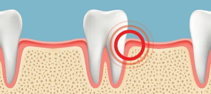 چرا دندان های ما درد می گیرند و چه باید بکنیم؟