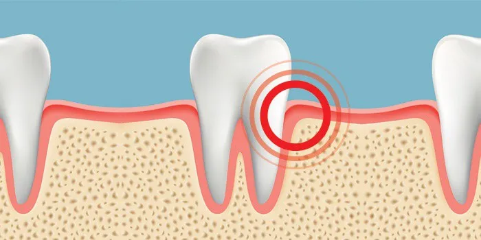 چرا دندان های ما درد می گیرند و چه باید بکنیم؟